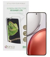 anco 3D Expert Lite Folie für Honor Magic8 Lite 4051805966943